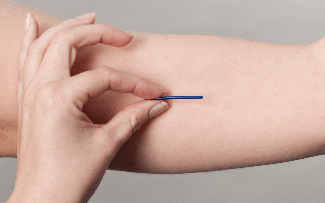 Implantes hormonais: vantagens e desvantagens