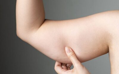 Qual o melhor tratamento para sarcopenia?