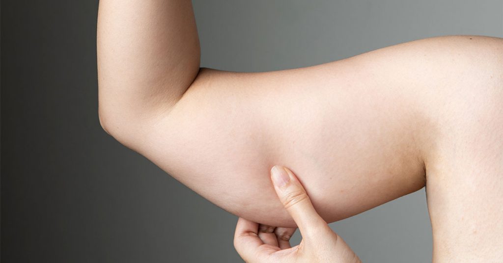 Qual o melhor tratamento para sarcopenia?