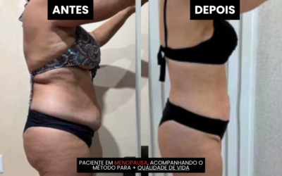 Nutricionista em Porto Alegre: com experiência em Menopausa